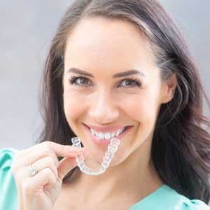 Invisible braces